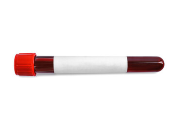 Wall Mural - Blood in test tube with blank label on white background. Medical analysis