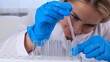 © Евгения Медведева - professional scientist takes a sample for a medical experiment. A research chemist works in a laboratory with a micropipette and a microscope
