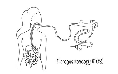 Wall Mural - Fibrogastroscopy