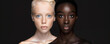 © IBEX.Media - Two women, one with pale skin and blue eyes, and the other with dark skin, posed side by side in a striking display of contrast and diversity, celebrating beauty and individuality