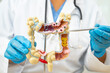 © Pakawadee - Ulcerative Colitis. Intestine, appendix and digestive system, doctor holding anatomy model for study diagnosis and treatment in hospital.