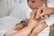 © Pixel-Shot - Mother smearing her little daughter ill with chickenpox in bedroom, closeup