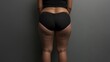 © Yeivaz - Woman with visible cellulite on her thighs and buttocks on gray background. Overweight liposuction