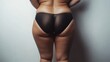 © Yeivaz - Woman with visible cellulite on her thighs and buttocks on gray background. Overweight liposuction