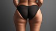 © Yeivaz - Woman with visible cellulite on her thighs and buttocks on gray background. Overweight liposuction