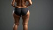 © Yeivaz - Woman with visible cellulite on her thighs and buttocks on gray background. Overweight liposuction
