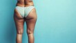 © Yeivaz - Woman with visible cellulite on her thighs and buttocks on blue background. Overweight liposuction