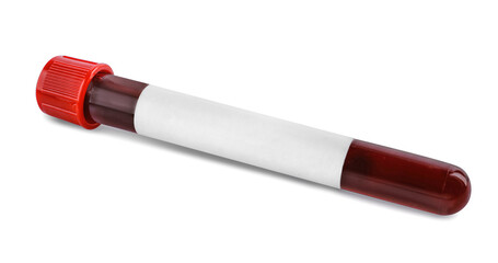 Wall Mural - Blood in test tube with blank label on white background. Medical analysis