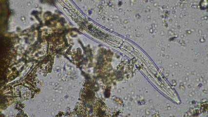 Wall Mural - microorganisms and soil biology, with nematodes and fungi under the microscope. in a soil and compost sample