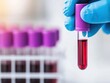 © nitnicha - Close-up of a gloved hand holding a blood sample in a test tube, showcasing laboratory environment and medical examination.