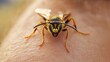 © atipong - Swollen leg after a wasp bite. POV.
