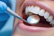 © Nejron Photo - Close-up of a dental check-up with mouth mirror tool
