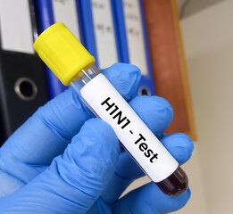 Poster - Blood Sample for H1N1Flu (swine flu) test. Influenza virus. Rapid Influenza Diagnostic Test (RIDT).