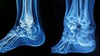 © otwdesign - X-ray of a Human Foot and Ankle, Viewed From Two Angles