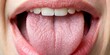 © Curie - A healthy tongue is smooth, pale pink with tiny papillae, a few taste buds, and a subtle texture, free of ulcers, redness, or coating.