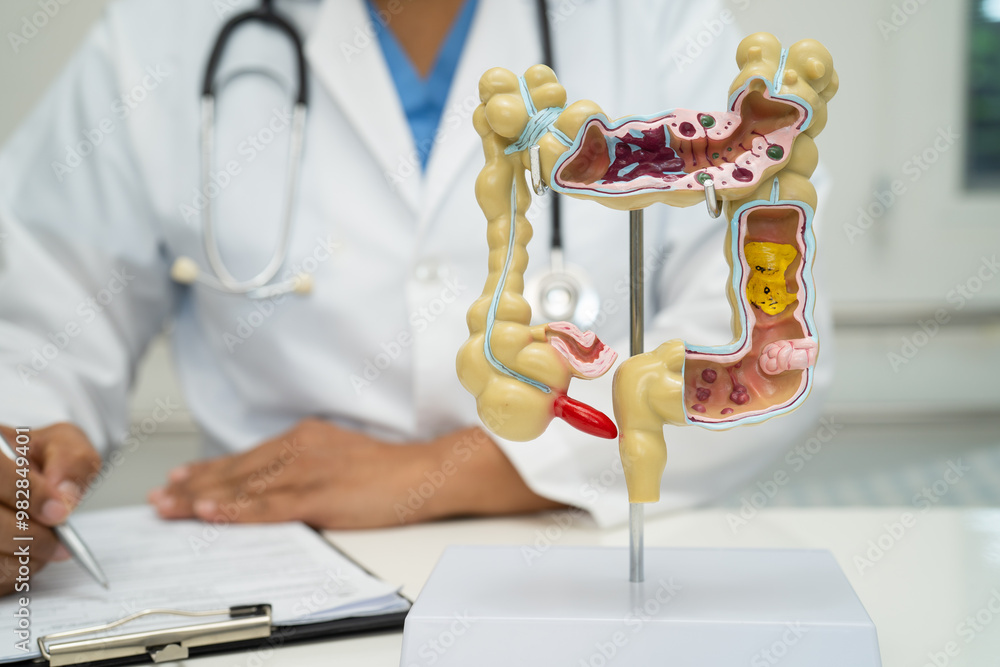 Intestine, appendix and digestive system, doctor holding anatomy model ...