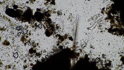 Wall Mural - microorganisms and soil biology, with nematodes and fungi under the microscope. in a soil and compost sample