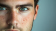 © Bonsales - Close-up of young man with freckles, piercing blue eyes, intense gaze, masculine features, facial hair, personal portrait concept