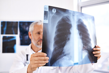 Poster - Senior doctor, study and xray for thinking, health service and orthopedic man with ideas for lung surgery. Medicine, radiology and analysis for bronchitis and problem solving with surgeon in clinic