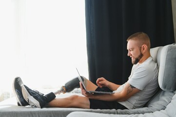 Man amputee with prosthetic leg disability on above knee transfemoral leg prosthesis artificial device using laptop at home. People with amputation disabilities everyday life