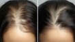 © Alpha - Head before and after hair loss treatment, detailed view of scalp with reduced thinning and visible hair growth, Hyper-Realistic, Neutral Lighting