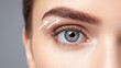 © radekcho - Blepharoplasty concept. Closeup view of lady eye with arrows point in direction of planned oculoplastic surgery to tighten and lift the skin around the eyes.