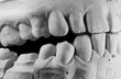 © Klochkov - Creepy white plaster teeth. Human jaws with teeth. Dental cast of teeth