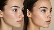 © Alpha - Before-and-after sequence of a woman applying concealer and foundation to cover acne scars, showcasing dramatic improvements in skin texture and tone