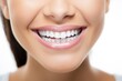© Putt_Sanplee - A joyful patient removing their braces for the first time, revealing a perfectly aligned smile