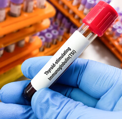 Poster - Blood sample for Thyroid stimulating Immunoglobulin (TSI) test. Throtropin binding inhibitory Immunoglobulin. Anti TSHR Ab.