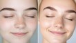 © Business Image - Skincare transformation: before and after split screen for beauty and wellness concepts