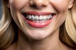 © Евгений Порохин - A woman with braces on her teeth is smiling