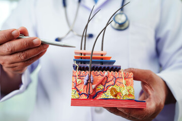 Hair transplant, Asian dermatologist doctor holding skin structure anatomy model for treatment in hospital.