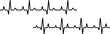 © Haji - Heartbeat line set. Heart pulse collection. Emergency EKG monitoring. Electrocardiogram. vector illustration