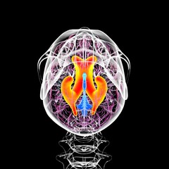 Wall Mural - Enlarged lateral ventricles of the brain, 3D illustration