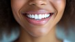 © Irina Kozel - Close-up of a smiling woman showcasing bright, white teeth and healthy gums against a neutral background