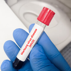 Poster - Blood sample for the Marburg virus test. Medicine and health concept. Marburg haemorrhagic fever.