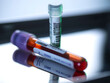 © Westend61 - Blood vials and DNA samples used for medical testing and research.