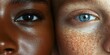© Denis - Close-up of two distinct faces showcasing diverse skin tones and eye colors, one with deep brown skin and dark eyes, the other with fair skin, freckles, and striking blue eyes