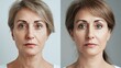 © Denis - Transformation of a woman's appearance through skincare, highlighting before and after effects in a studio setting with neutral background