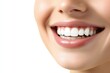 © Tam5 - Woman Smiling After Teeth Whitening Procedure