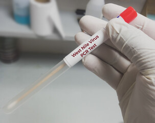 Canvas Print - Swab sample for West Nile virus(WNV) testing, mosquito-borne disease