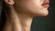 © fourtakig - Side profile view of a person's neck, revealing the painful-looking blisters and crusting typical of herpes simplex