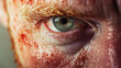 © Kanchanit - Close-up Detailed Image of Contact Dermatitis on Face with Red Itchy Rash and Blisters Showing Severe Skin Inflammation