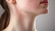 © Kanchanit - Medical Illustration of Rubella Rash on Neck, Featuring Fine Pink Spots on Skin for Dermatological Analysis