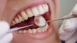 © Abdul - Dentist performing a dental bonding procedure to repair a broken tooth