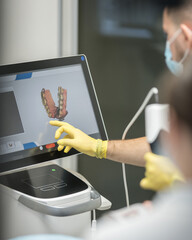 dentist uses intraoral scanner to create 3d digital model of patient's mouth. the screen displays 3d