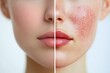 © Jennie Pavl - Healthy Skin Comparison: Before and After