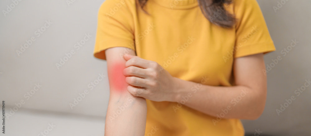 Scratching Reaction woman itching and scratching itchy arm. Sensitive Skin Allergic ...