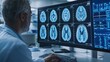 © nicole - Close-up of scientist analyzing brain scan images on monitor, detailed neural pathways symbolize dementia research in medical lab setting.